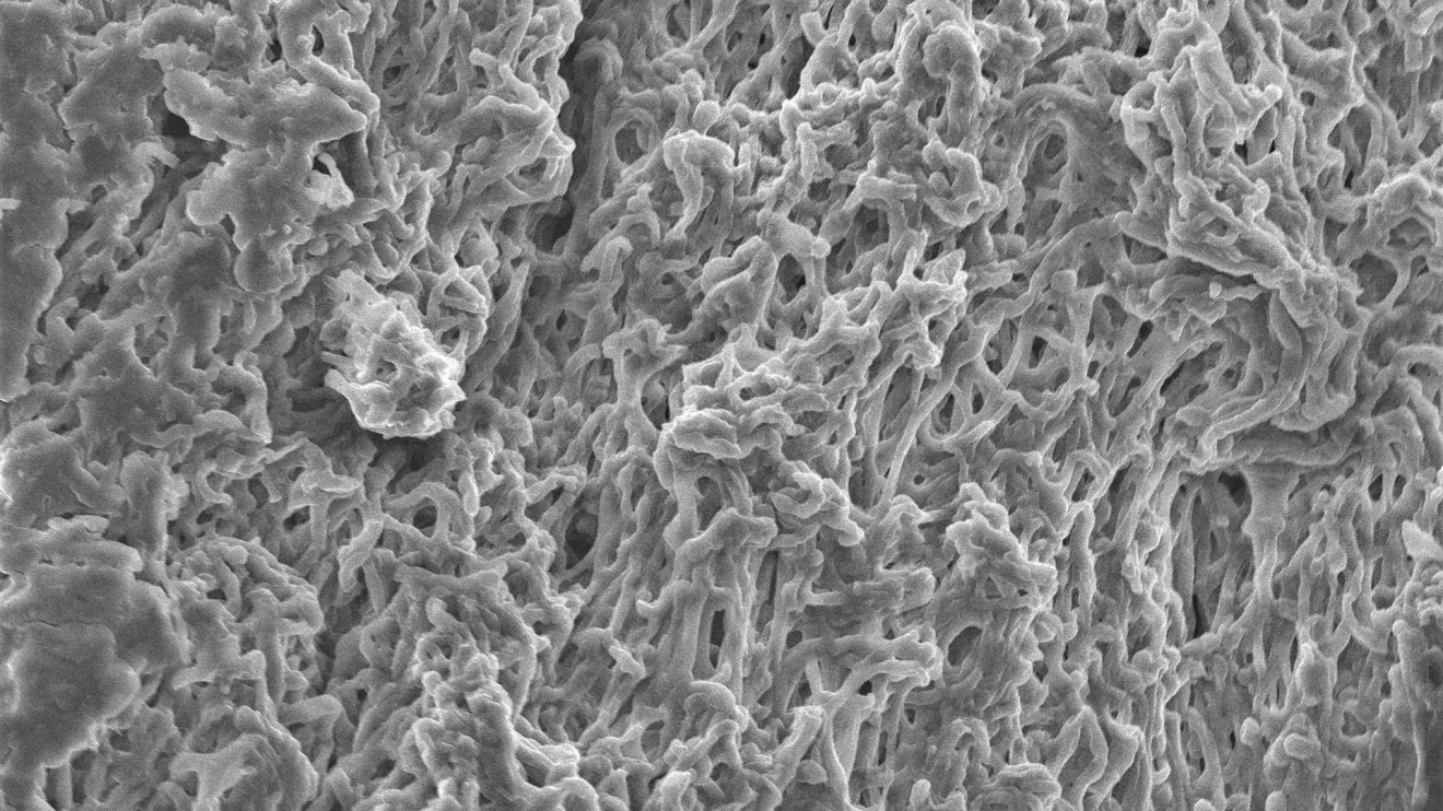 Mycelium-netwerk-(hyphae)---Scanning-electron-microscopy-(SEM)